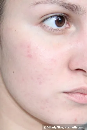 Alapítvány l oreal lumi MAGIQUE d3 árnyékban (világos bézs arany) vélemény (alapozó) Alapítvány l oreal lumi MAGIQUE árnyékban d3 (világos bézs arany) véleménye