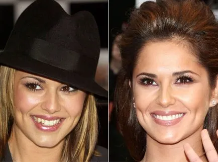 Mosolyogj egy millió az egyik csillag volt fogászati ​​problémák