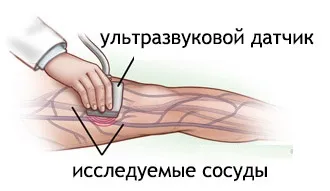 Uzi hajók és vénákban kell tudni (kell) Uzi hajók és vénákban kell tudni