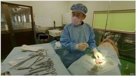 Növekvő szervek transzplantációs laboratóriumban