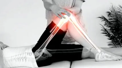 deformitása