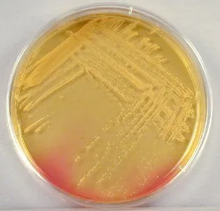 Staphylococcus aureus a torokban tünetek, kezelés bakteriofág fotó