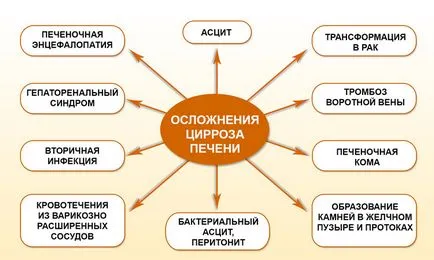 Alkoholos cirrhosis tünetek és jelek, a kezelés és a prognózis (cirrhosis) Alkoholos cirrhosis tünetei, a kezelés és a prognózis