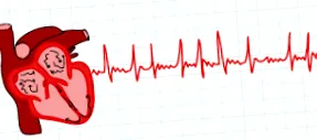 cardioclass