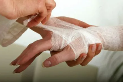 Mi a teendő, ha a vágás a lábak, karok vagy az arc, elsősegély vágások, népi jogorvoslati kezelésére (segítség) Mi a teendő, ha egy vágott láb, a kéz vagy az arc, elsősegély vágások, népi jogorvoslati kezelésére