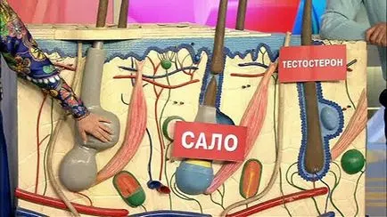 Elena Malysheva a pattanások kezelésére