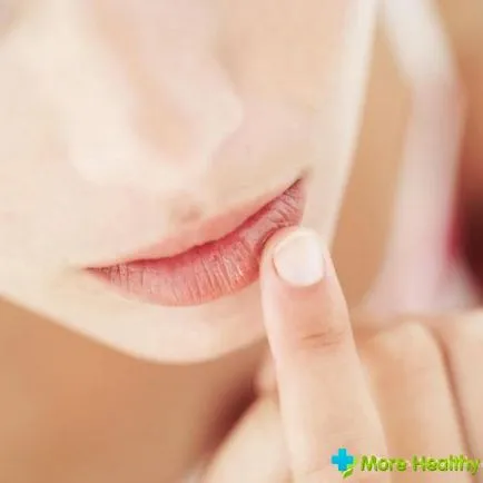 Mivel a mi jelenik meg az ajkak herpes okok, kezelés, a tünetek (ajak) Mivel a mi jelenik meg az ajkak herpes okok, kezelés, a tünetek