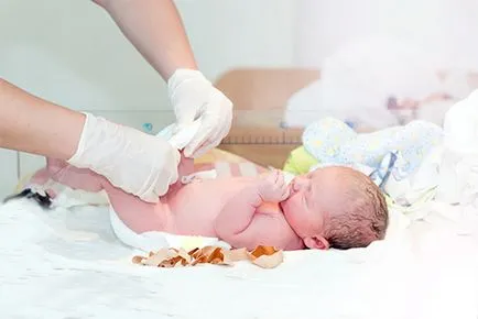 Hogyan kell kezelni az újszülött köldök Zelenko