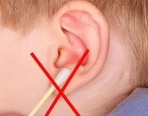 Hogyan kell helyesen tisztítani a fülét a felnőtt és gyermek tippek (hasznos) Hogyan kell helyesen tisztítani a fülét a felnőtt és gyermek tippek