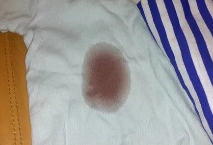 Hogyan, hogy a helyszínen a vörösbor, mint a mosás ruha, szőnyeg, bútor