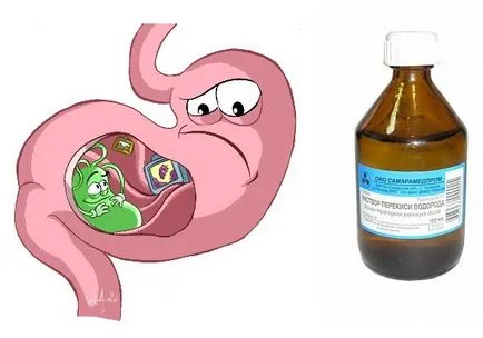 Kezelése gastritis hidrogén-peroxiddal vélemény - egyszerű és gyors receptek kezelésére zdravoline (gastritis) Kezelése gastritis hidrogén-peroxiddal vélemény - egyszerű és gyors receptek kezelésére zdravoline
