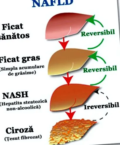 súlyos