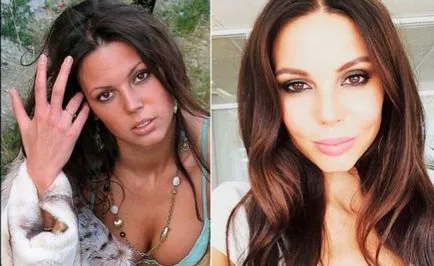 Oksana Samoilova előtt és után műanyag - 300
