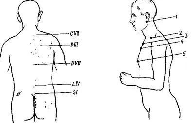 Azonosítása a gerinc pont - magán-tanulmány - ortopédiai diagnosztika - orvosi eReader