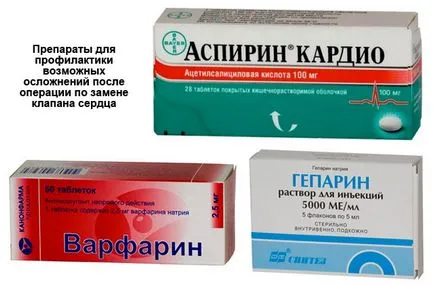 A szelep működését csere középpontjában, hogy a, jelzések, szövődmények (szív) A művelet a műbillentyű középpontjában, hogy a megjelölés, szövődmények