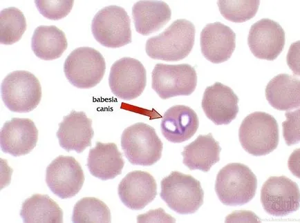 Piroplazmózisra, hogy az ilyen tünetek a babesiosis, Babesia paraziták