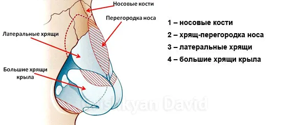 Orr háttámla púp és a nyereg orra deformáció (alak) Orr háttámla púp és a nyereg orra deformáció