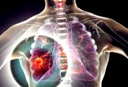 étrend