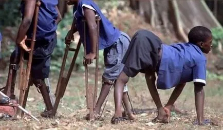 Polio okok, tünetek, kezelés, megelőzés