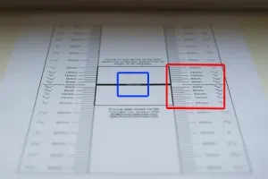 Ellenőrzés lencse elülső összpontosít hátlap