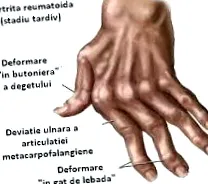 starších