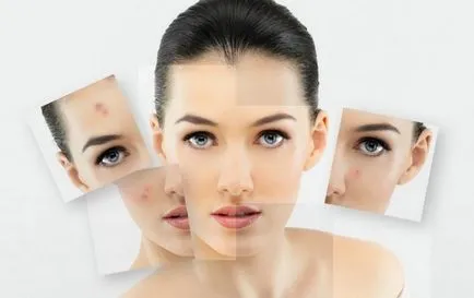 Bőrradír, miért kell végezni, mint egy otthoni peeling arc, Oriflame