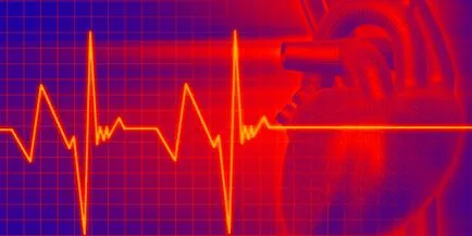 Tachycardia - tünetek és kezelés a népi jogorvoslati és tabletták (kezelés) Tachycardia - tünetek és kezelés tabletták és népi jogorvoslati