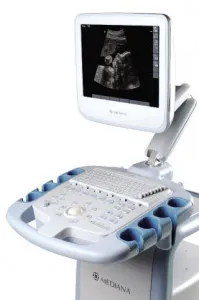 Az ultrahangos diagnosztikai rendszer smartsono ms-08