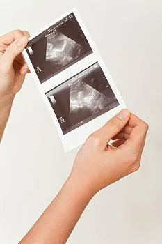 Uzi a menstruáció alatt, e csinálni ultrahang a méh, mint lehetséges, a hasüreg a menstruáció alatt
