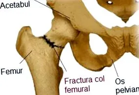 arcalife