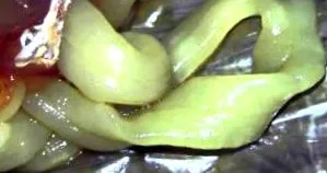 férgek vagy