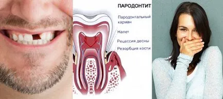 19 A lehetséges hatásai malocclusion