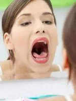 Tonsillitis - kezelés nélkül antibiotikumok