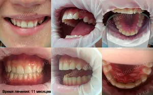 Nadrágtartók, klinika modern fogászat „kezes”