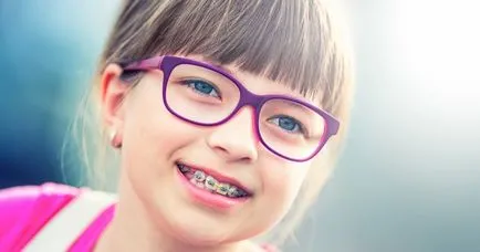 Braces gyerekeknek - típusú konzol rendszerek (féle) Merevítő gyerekek - típusú konzol rendszerek