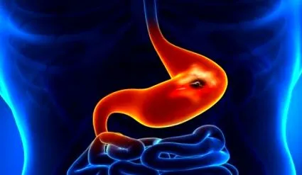 причини