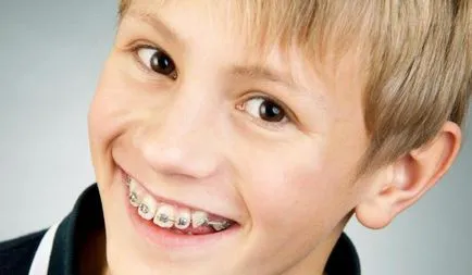 Gyermekek nadrágtartó típusok, telepítés fotók