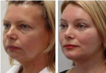 Torna az arc és a nyak (videó, fénykép óra) (hogyan kell csinálni) Torna az arc és a nyak (videó, fénykép órák)