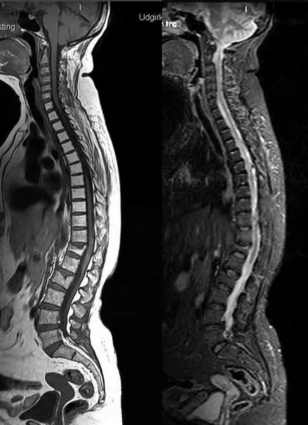 Hogyan kell csinálni egy MRI a gerinc