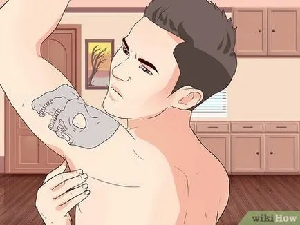 Hogyan kezelik a keloid
