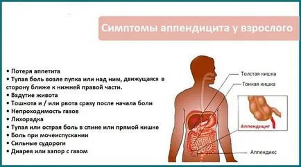 Hogyan lehet azonosítani vakbélgyulladás az otthoni, és az első jelei a tünetek vakbélgyulladás