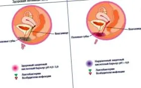 osteochondritis