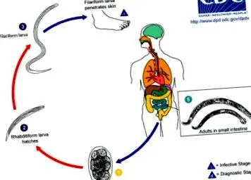 helminthiasis