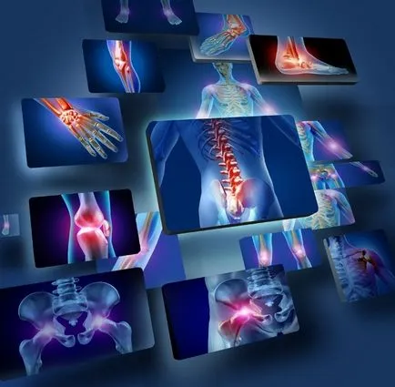 Hogyan lehet gyógyítani a betegséget elsődleges osteoarthritis modern módszerek kezelésére és megelőzésére (a betegség súlyosbodását kezdeti arthrosis ízületek modern kezelési eljárások megelőzésére) Hogyan lehet gyógyítani a betegséget elsődleges osteoarthritis modern módszerek kezelésére és megelőzésére