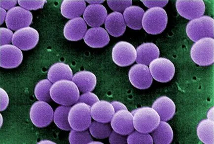 Hogyan lehet visszaállítani a gyermek bevétele után dysbiosis antibiotikumok, afta a baba, a baba egészséges!