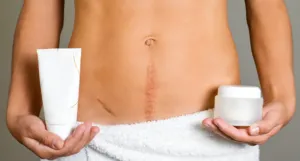 Keloid heg - azaz, hogyan kell tisztítani, kezelése (fotó)