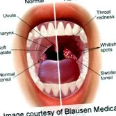 uvula