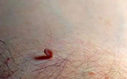 priznaky