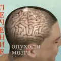 Enyhe agyrázkódás tünetei, kezelés (kezelés) Enyhe agyrázkódás tünetei, a kezelés