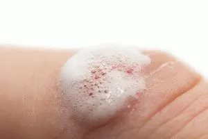 Hidrogén-peroxiddal kezeltük a Neumyvakin